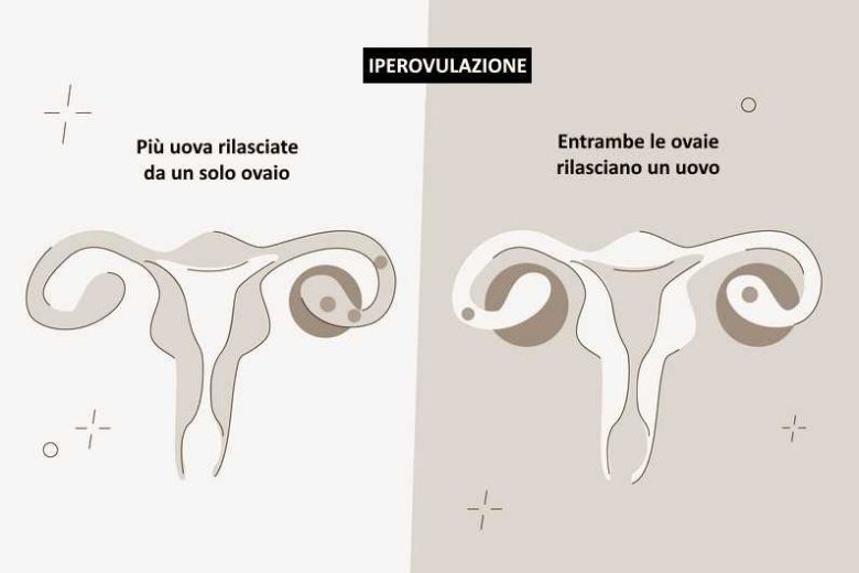 iperovulazione ovulazione multipla